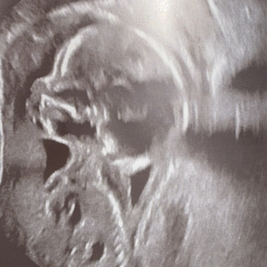 Photo shared by Joanna for their Babylist baby registry.