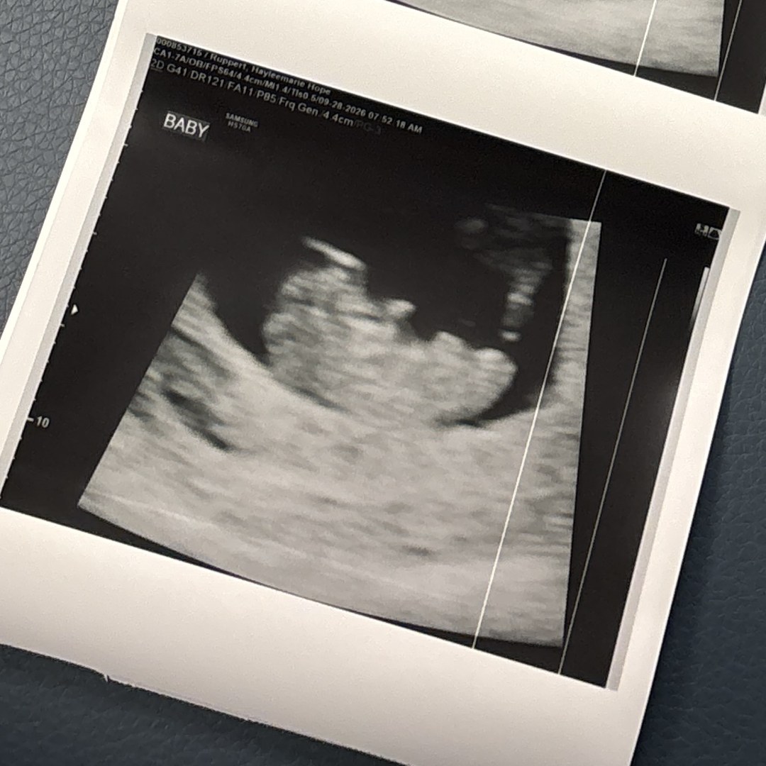 Photo shared by Hayleemarie for their Babylist baby registry.
