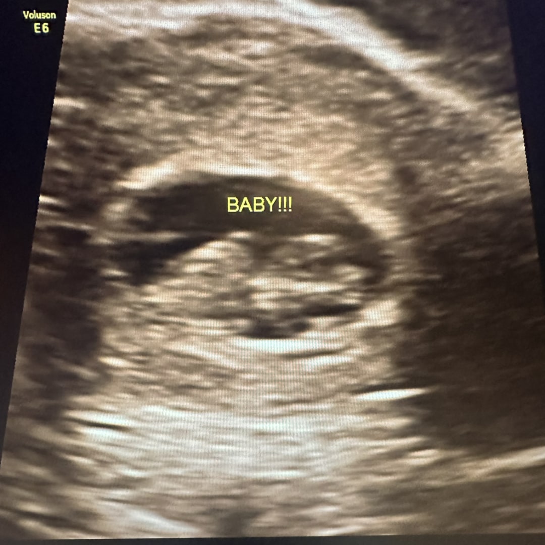 Photo shared by Monique for their Babylist baby registry.