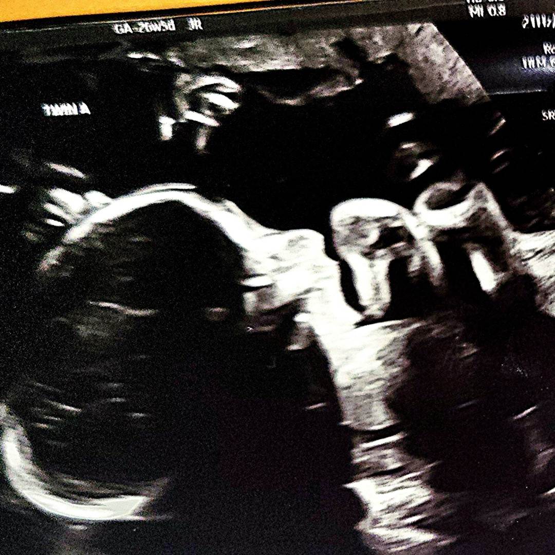 Photo shared by Jess for their Babylist baby registry.