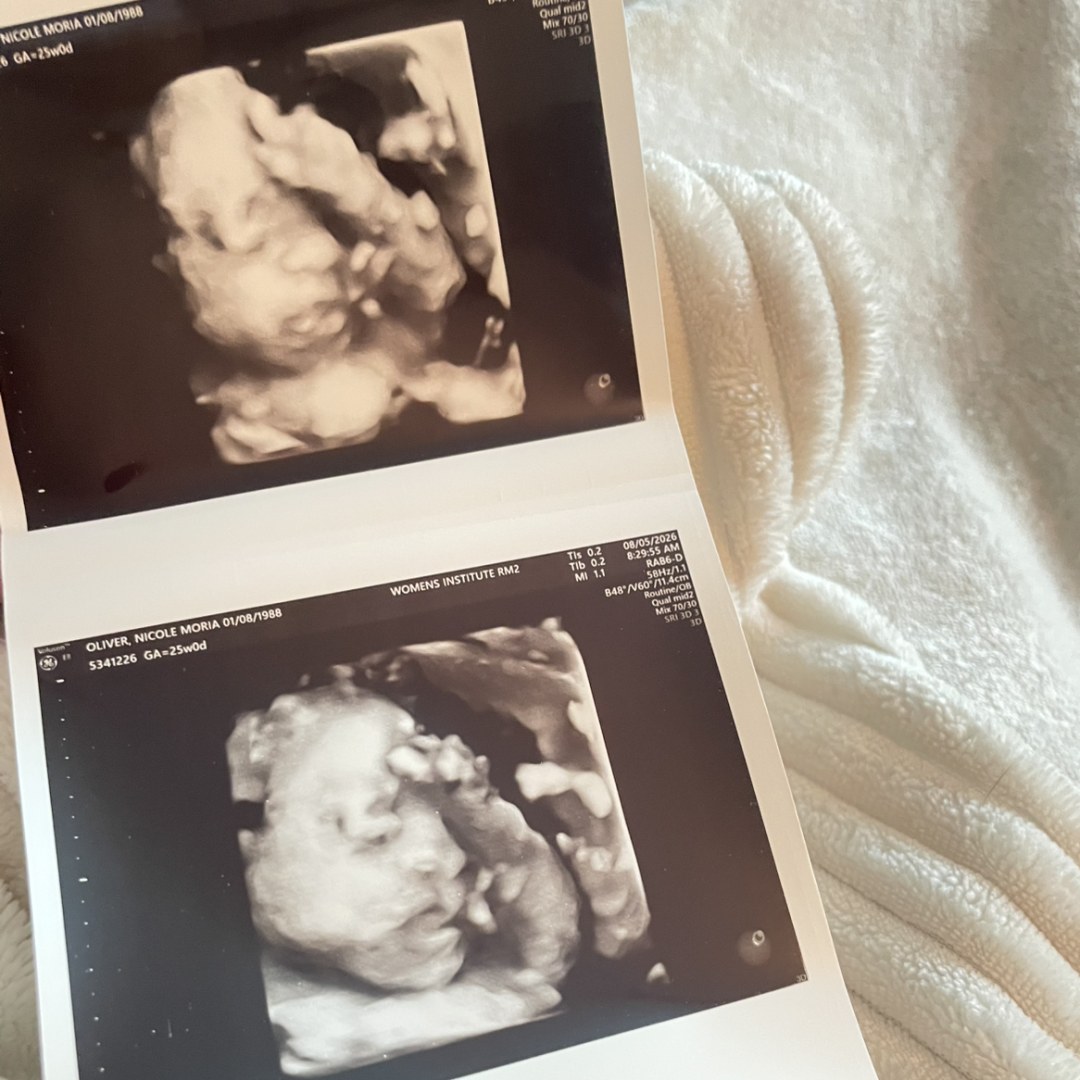 Photo shared by Nicole for their Babylist baby registry.