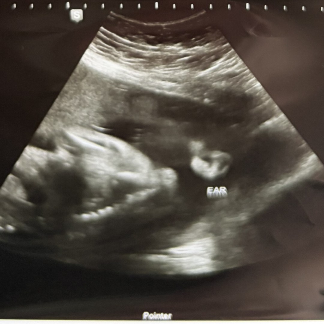 Photo shared by Ashley for their Babylist baby registry.