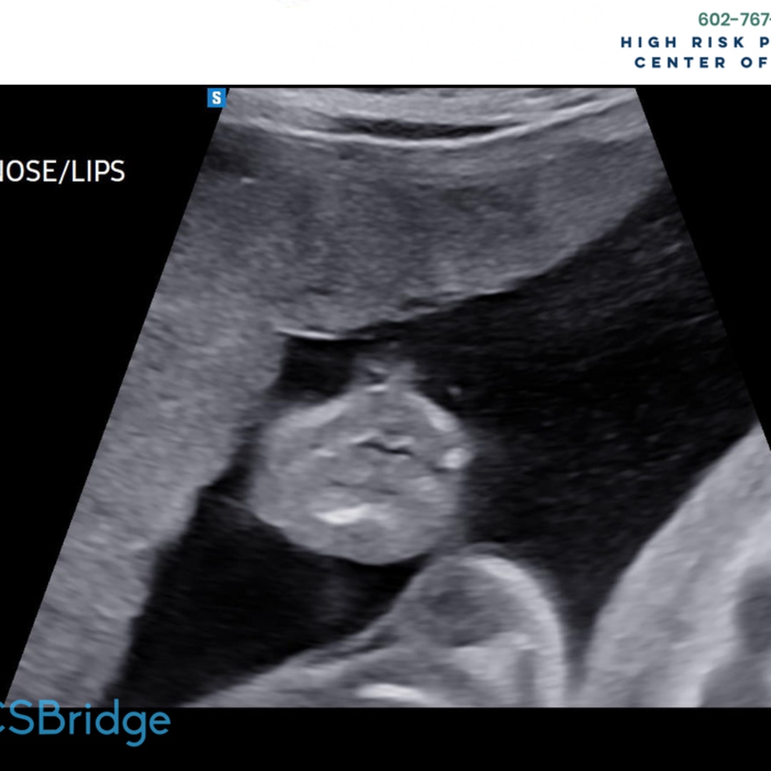 Photo shared by Elaina for their Babylist baby registry.