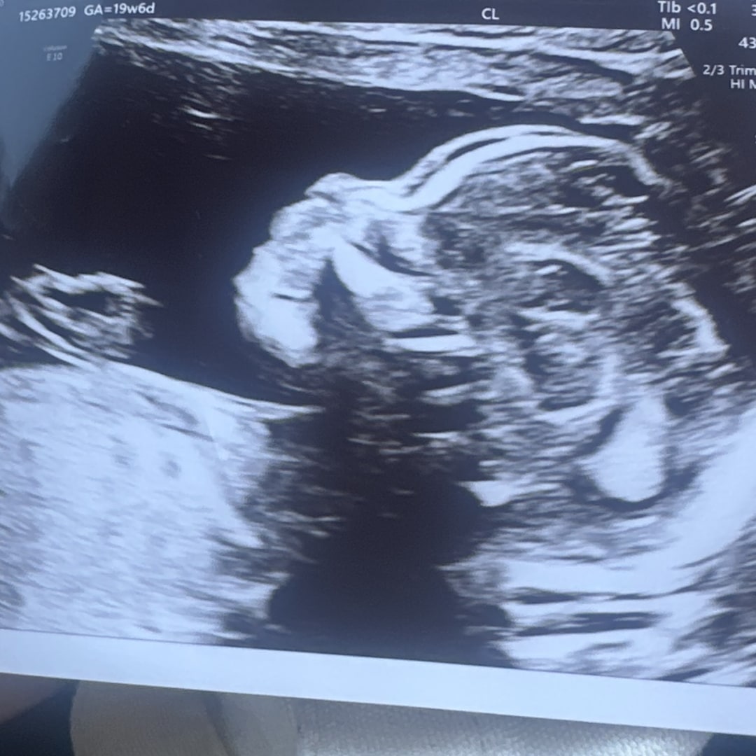 Photo shared by Deisy for their Babylist baby registry.