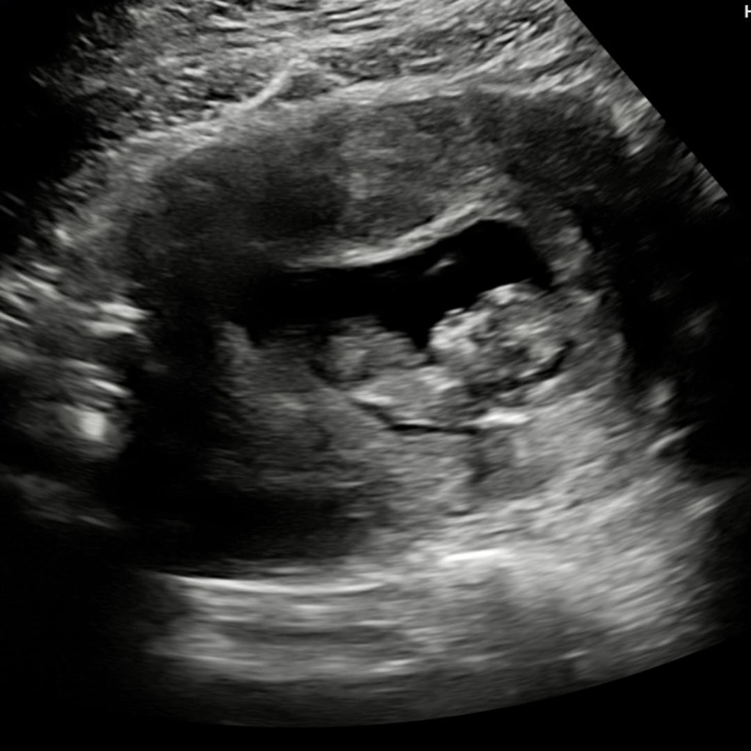 Photo shared by Leslie for their Babylist baby registry.