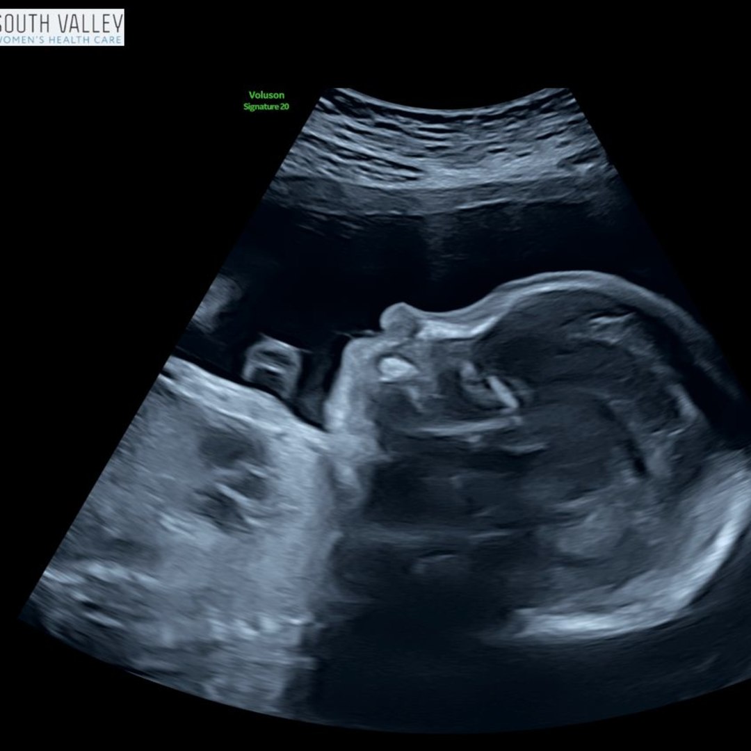 Photo shared by Yanina for their Babylist baby registry.