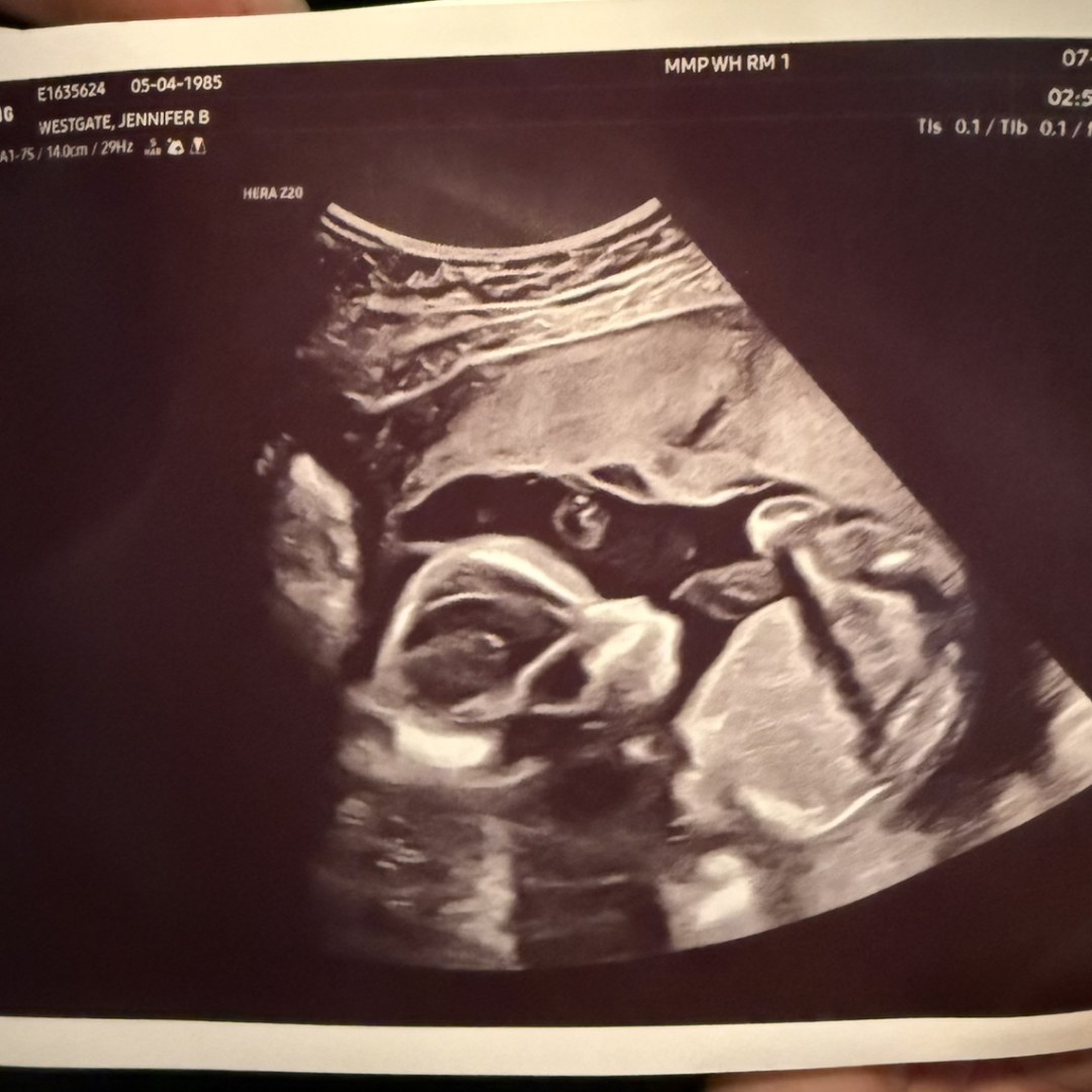 Photo shared by Jennifer for their Babylist baby registry.