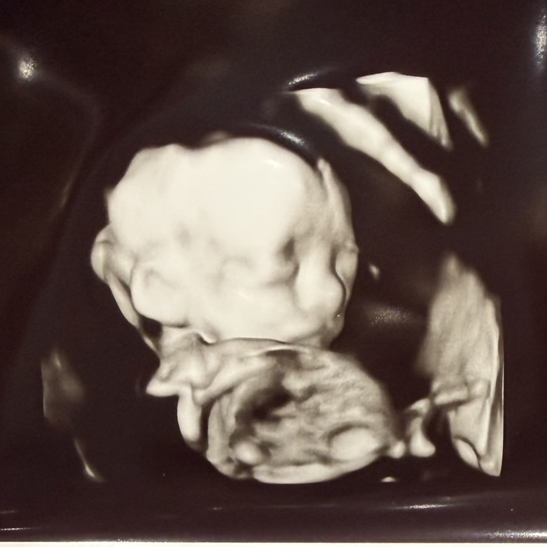 Photo shared by Rachel for their Babylist baby registry.