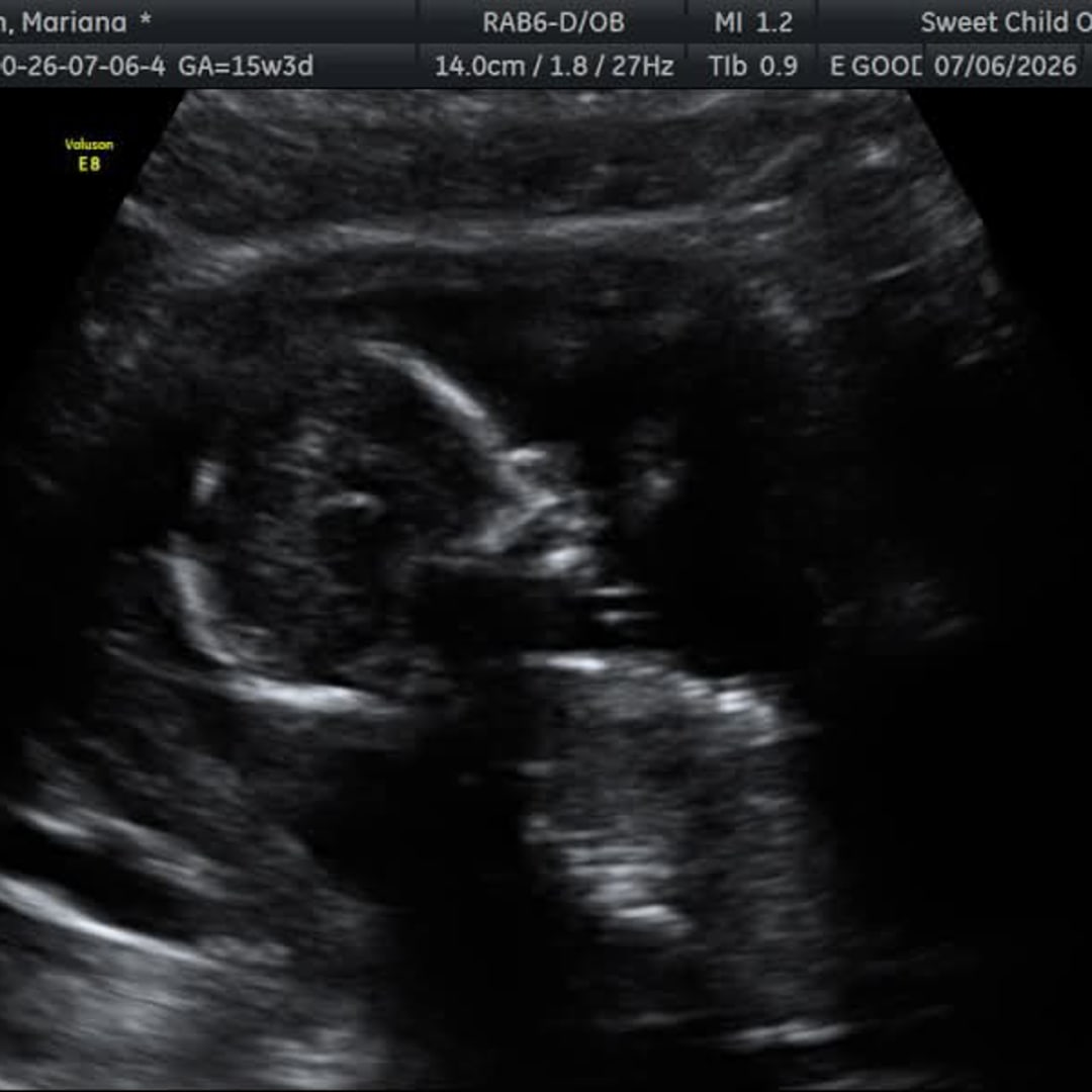 Photo shared by Mariana for their Babylist baby registry.