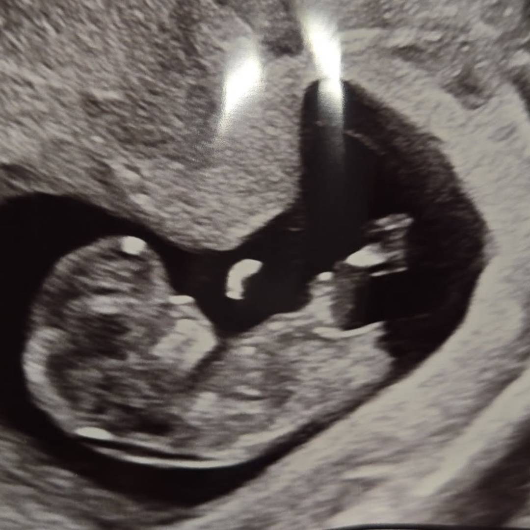 Photo shared by Alexa for their Babylist baby registry.