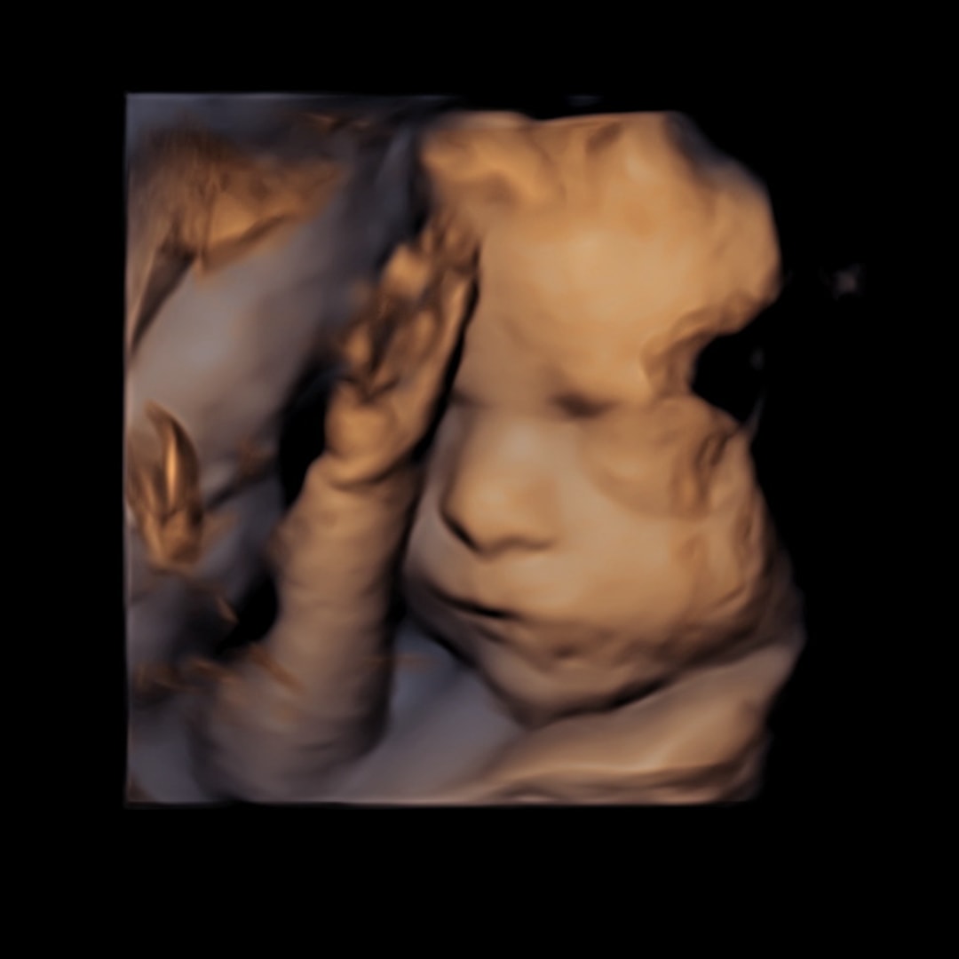 Photo shared by Victoria for their Babylist baby registry.