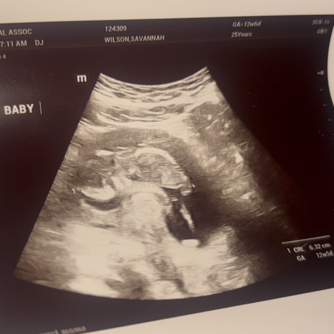 Photo shared by Savannah for their Babylist baby registry.