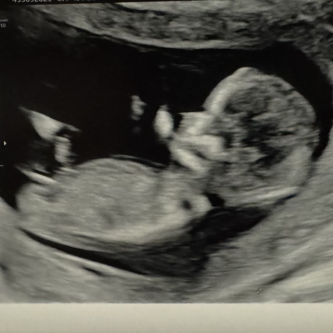 Photo shared by Ilana for their Babylist baby registry.