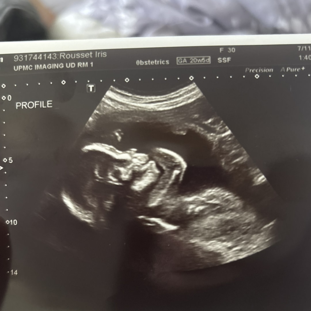 Photo shared by Iris for their Babylist baby registry.