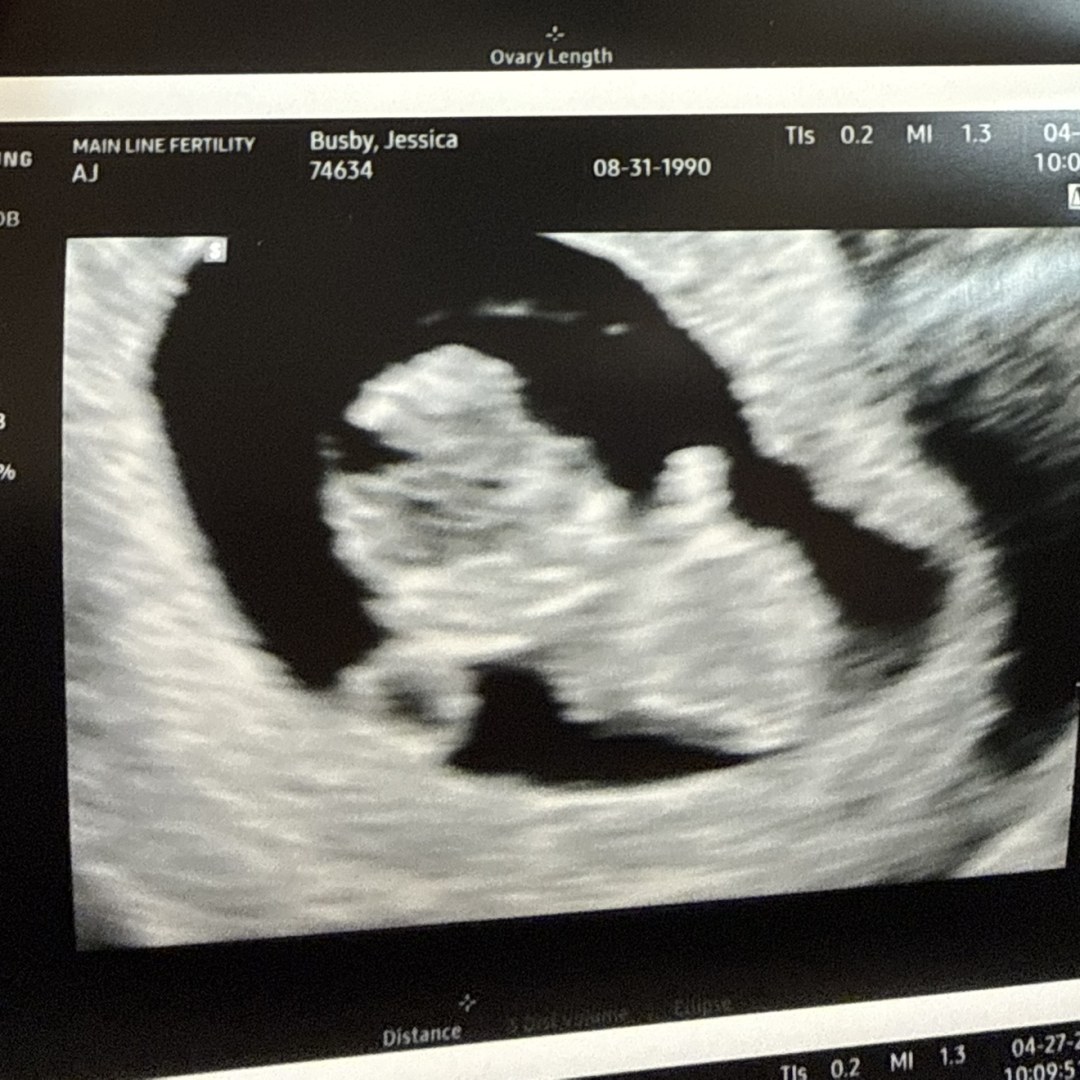 Photo shared by Chris for their Babylist baby registry.