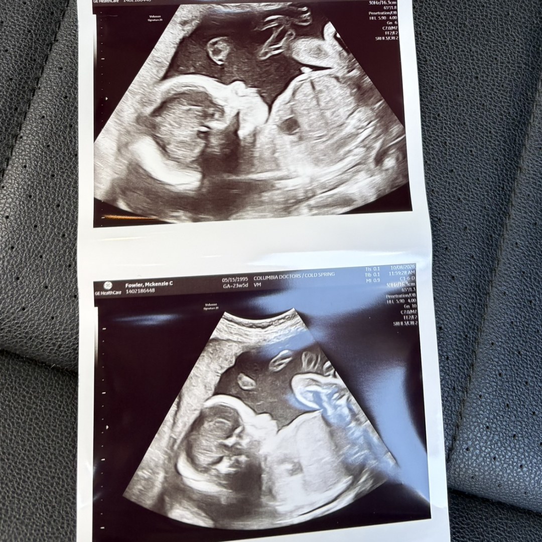Photo shared by McKenzie and Chris for their Babylist baby registry.