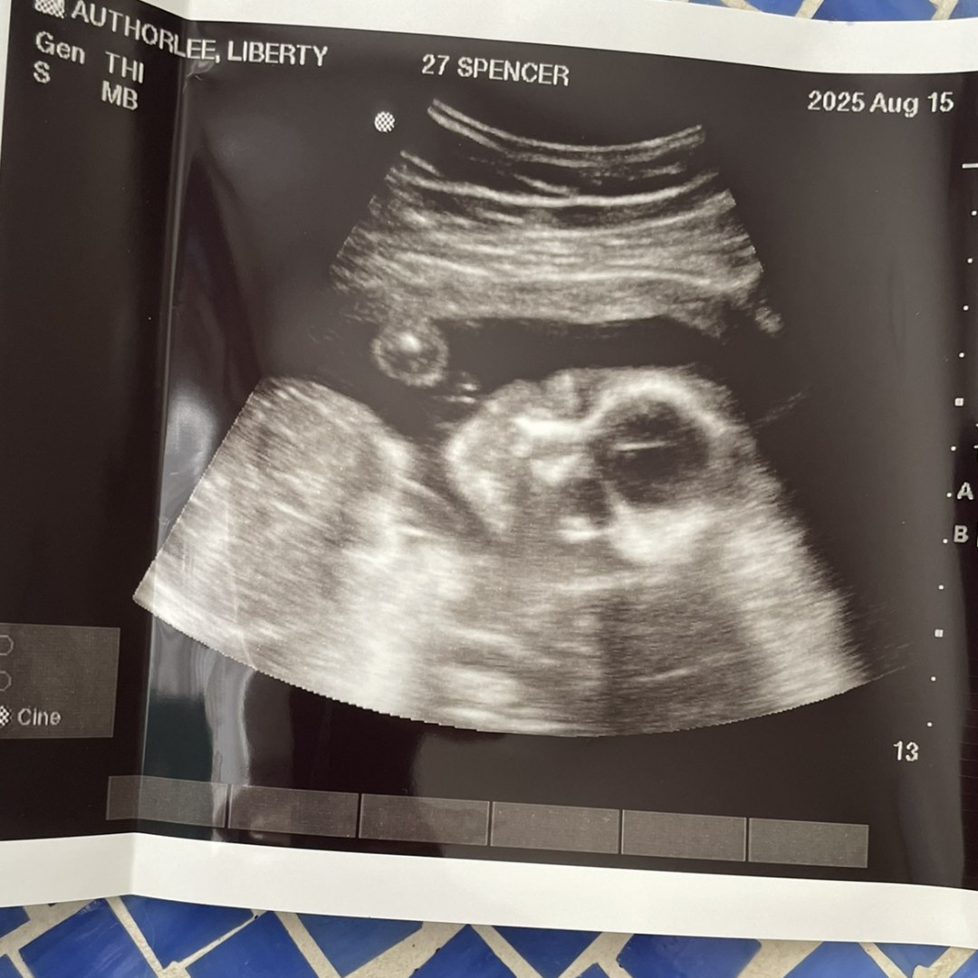 Photo shared by Liberty for their Babylist baby registry.