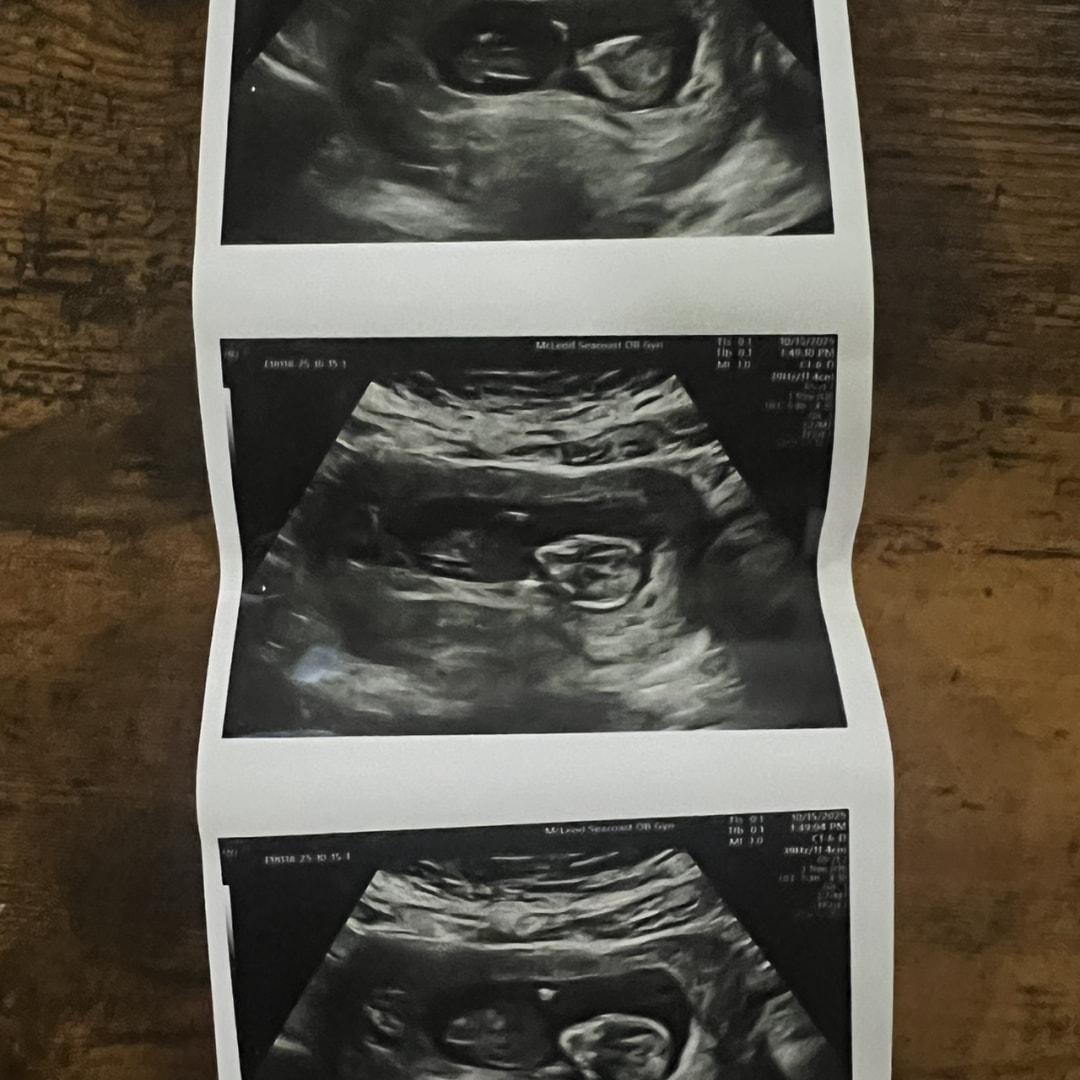 Photo shared by Gabriella for their Babylist baby registry.