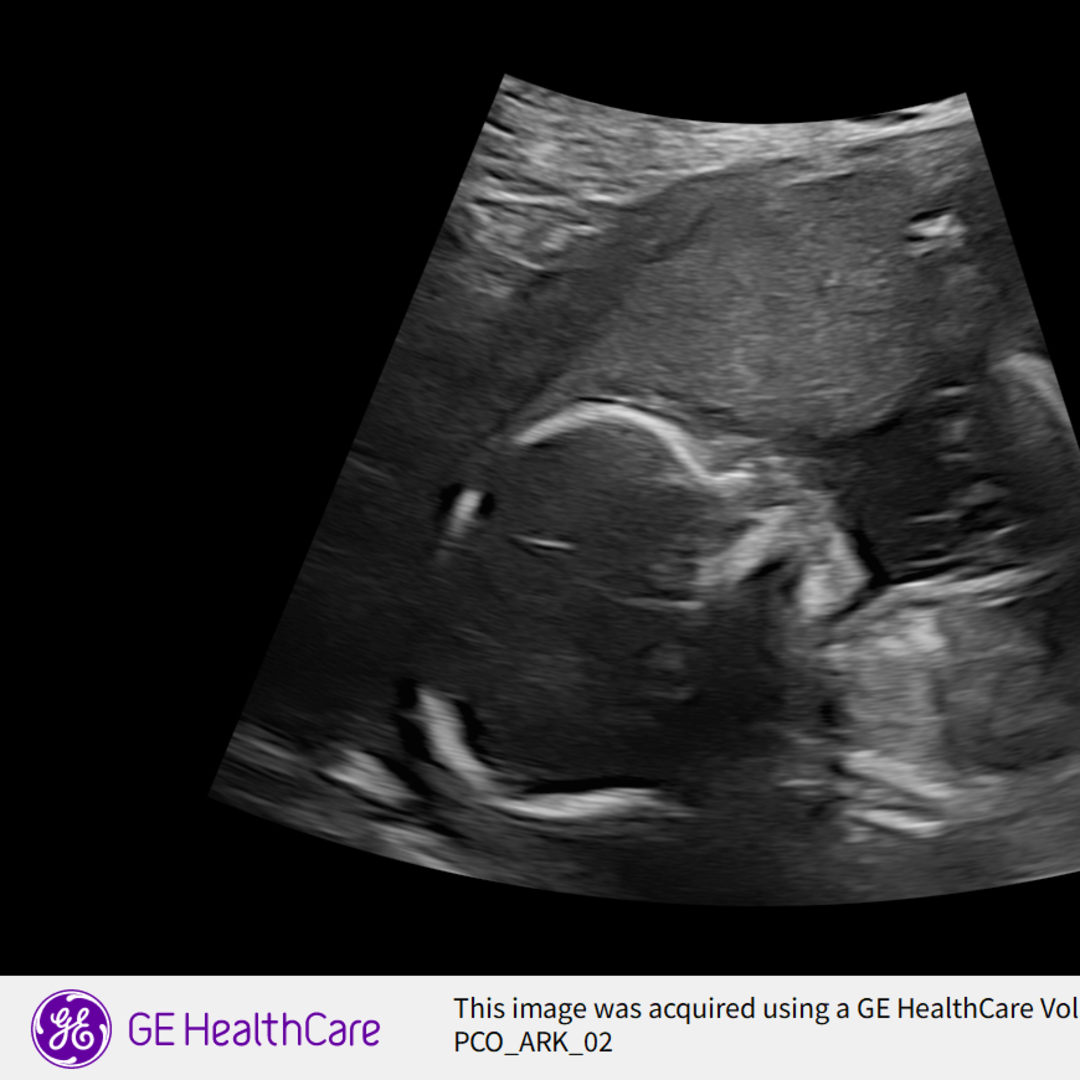 Photo shared by Hayley for their Babylist baby registry.