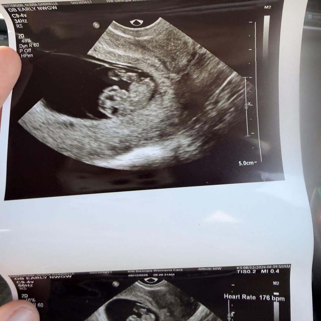 Photo shared by Olivia for their Babylist baby registry.