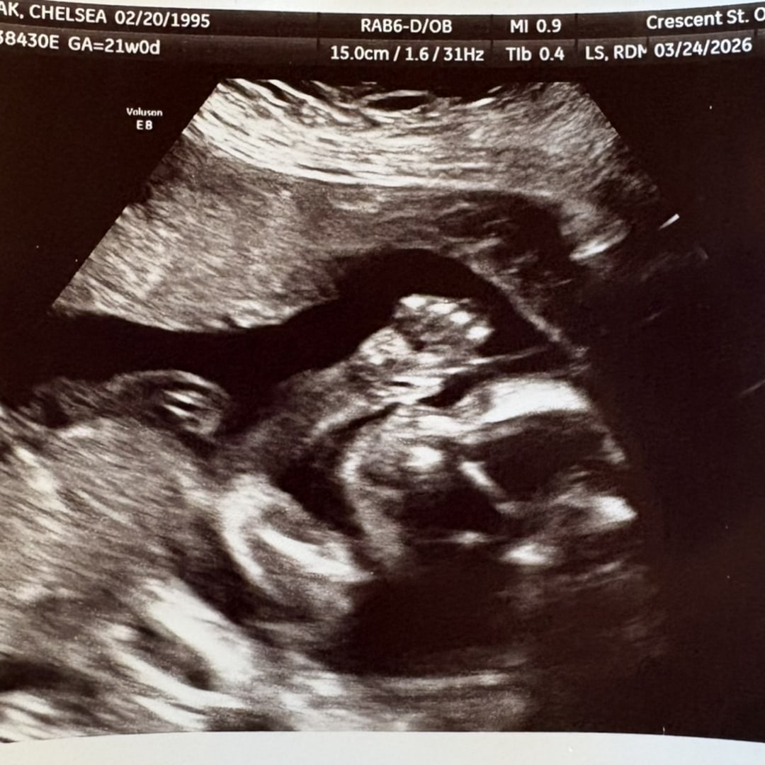 Photo shared by Chelsea for their Babylist baby registry.