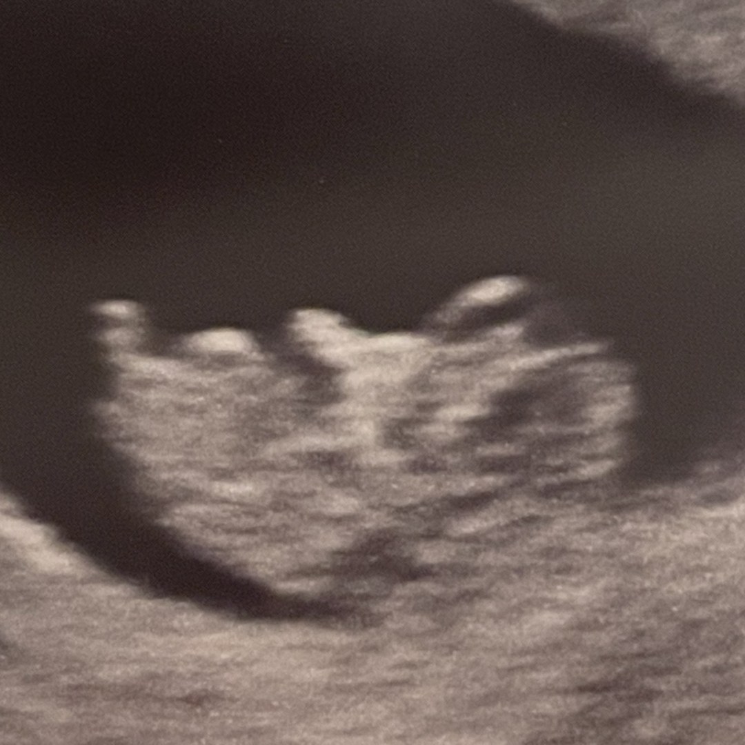 Photo shared by Haley for their Babylist baby registry.