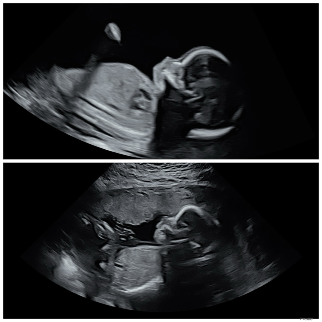 Photo shared by Brittany for their Babylist baby registry.