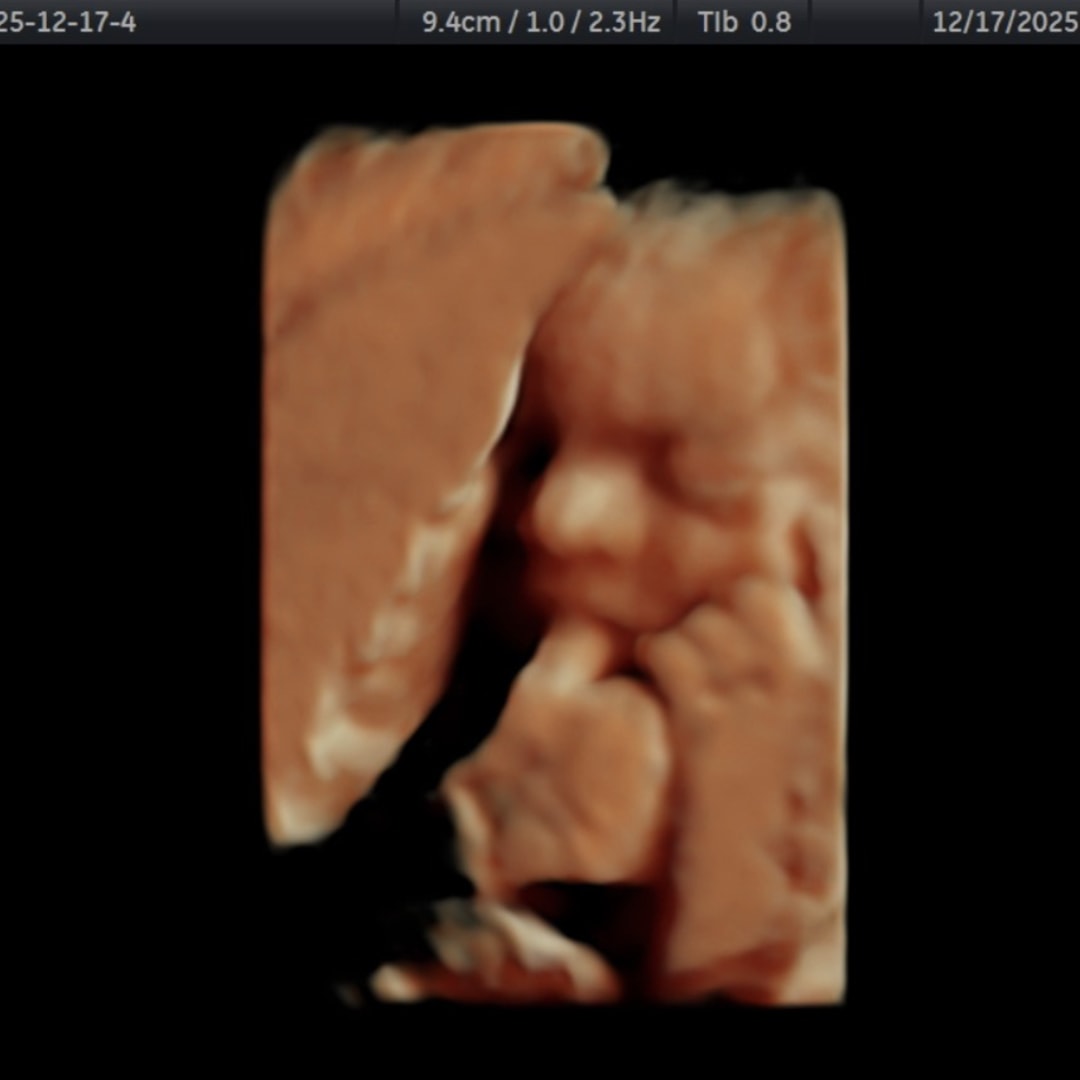 Photo shared by Megan for their Babylist baby registry.