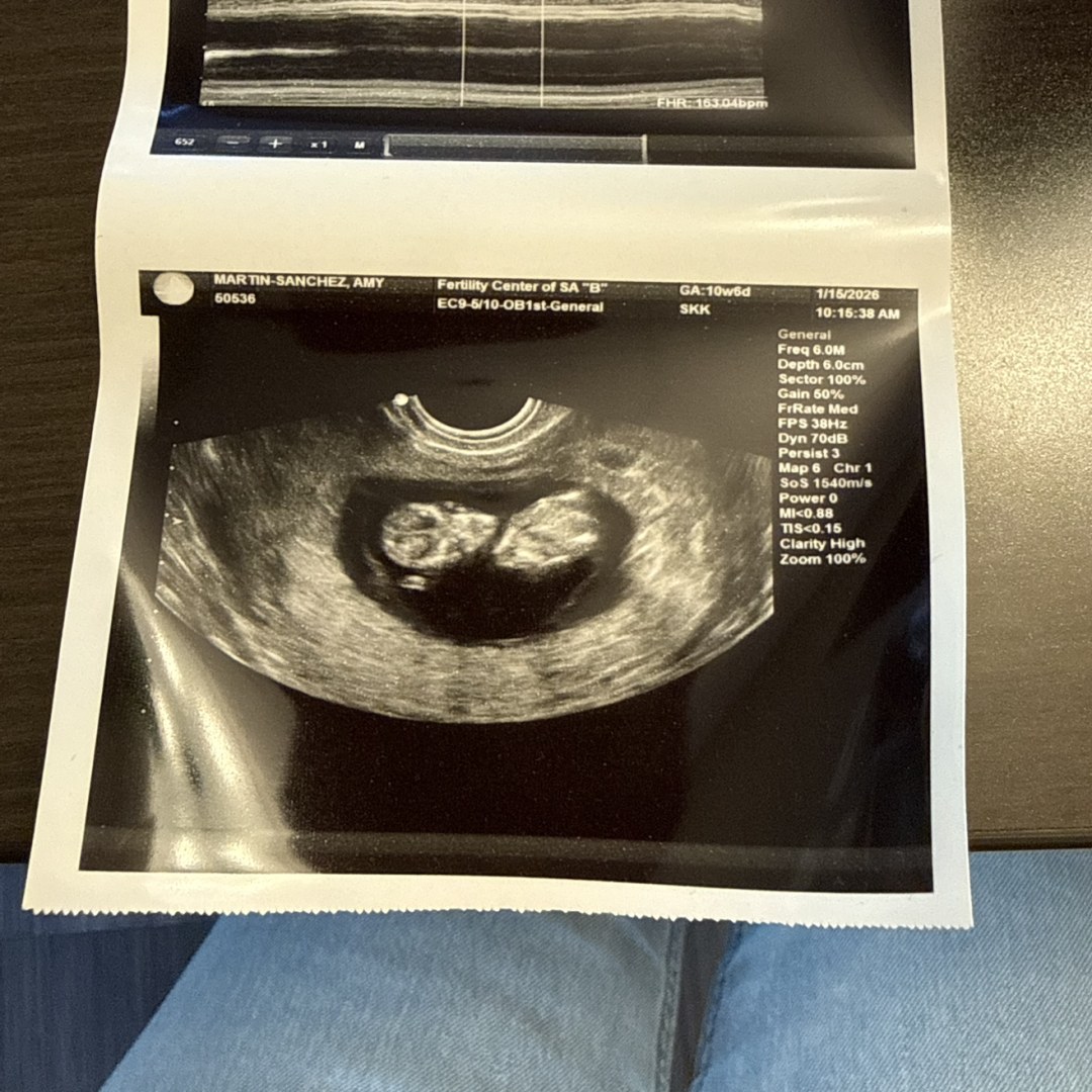 Photo shared by Amy for their Babylist baby registry.