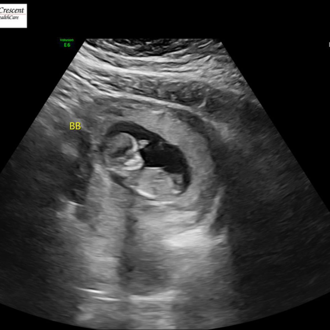 Photo shared by Georgina for their Babylist baby registry.