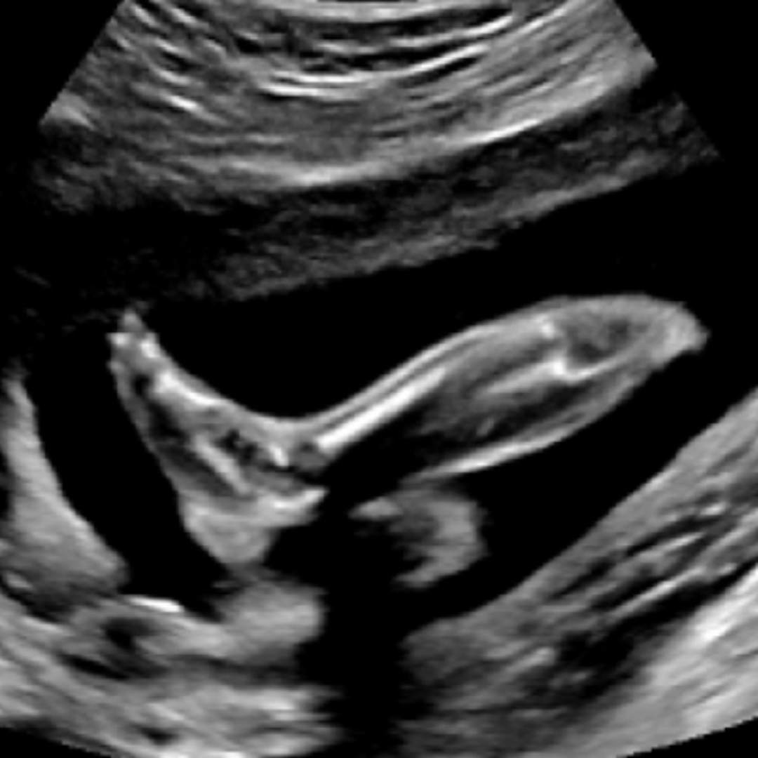 Photo shared by Caitlin for their Babylist baby registry.