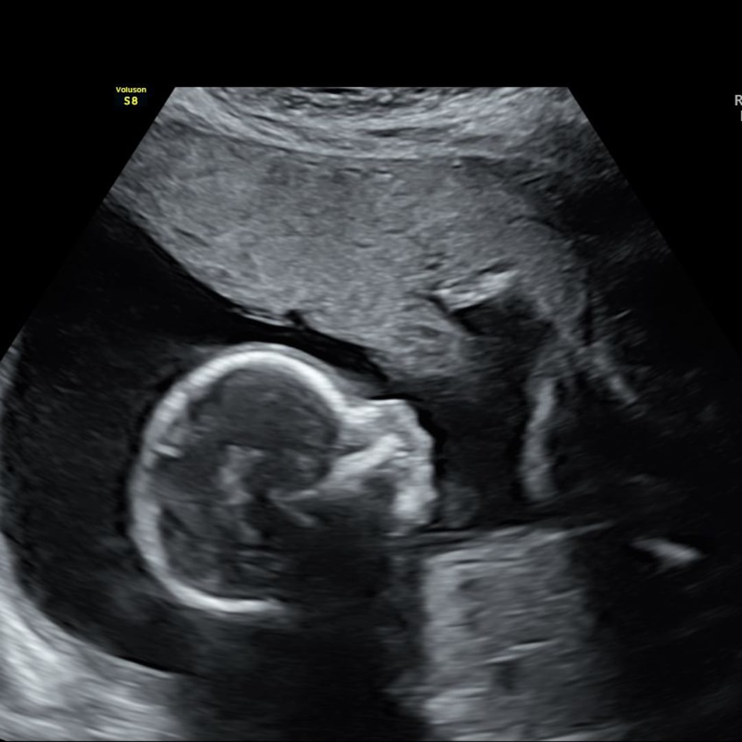 Photo shared by Alicen for their Babylist baby registry.