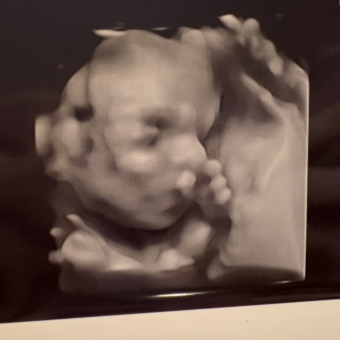 Photo shared by Gabrielle for their Babylist baby registry.