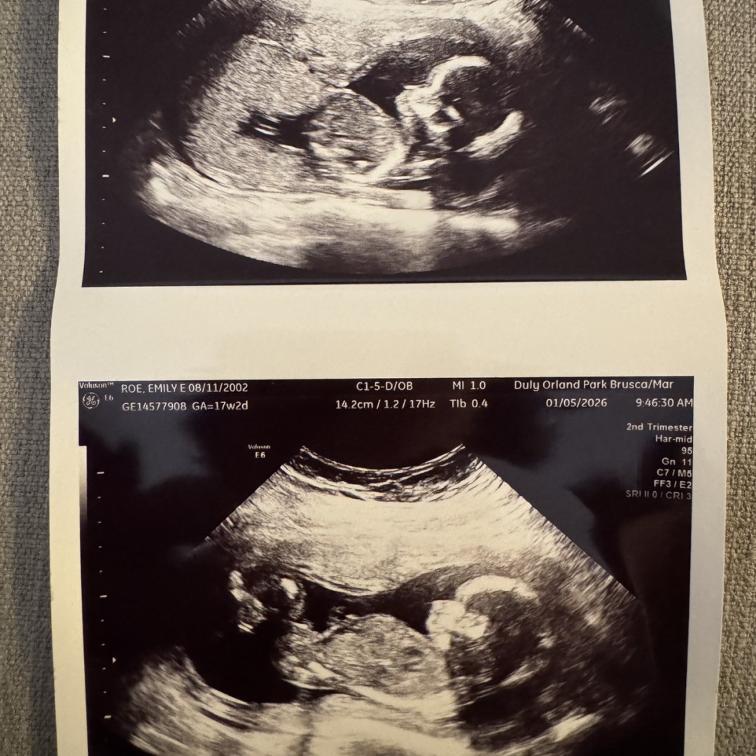 Photo shared by Emily for their Babylist baby registry.