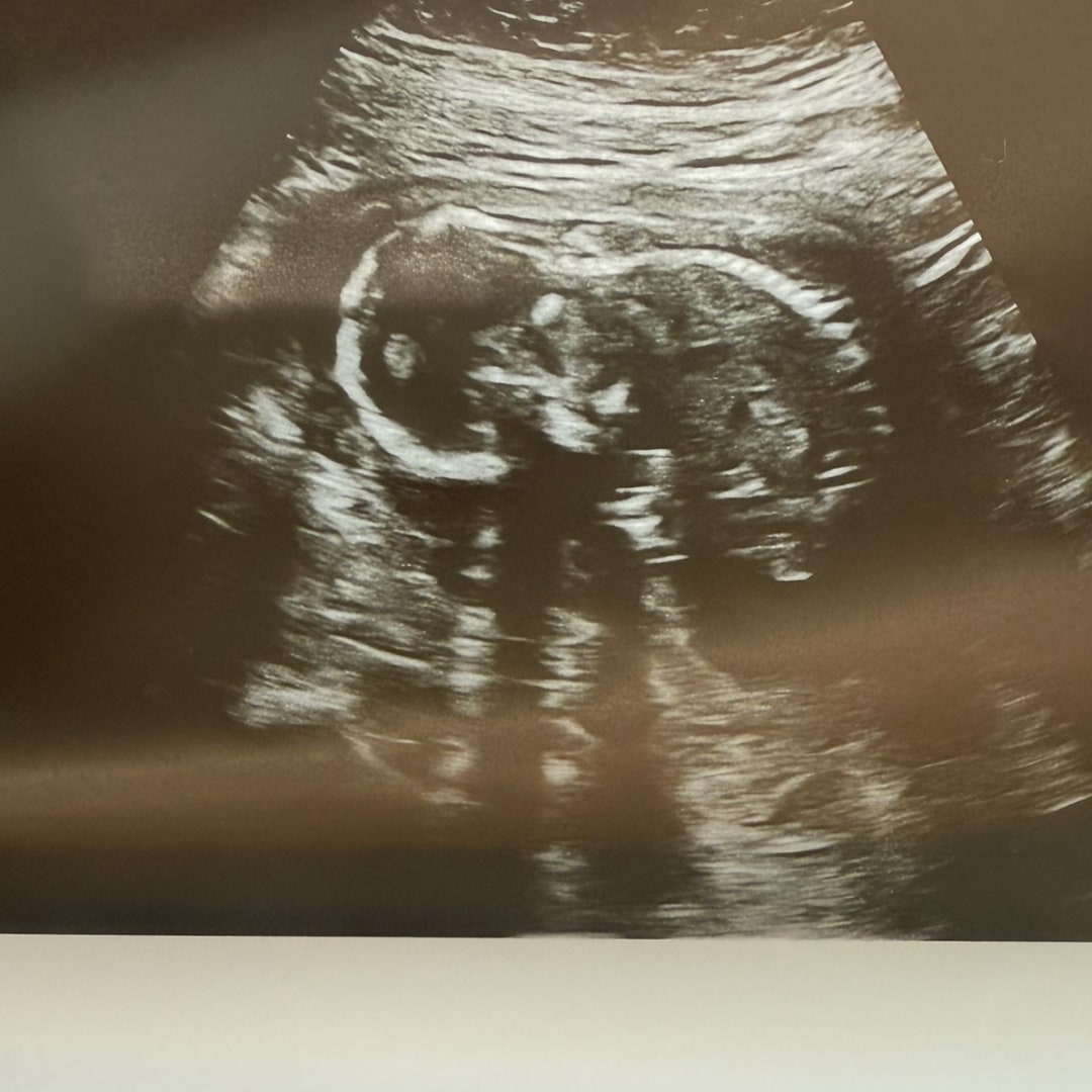 Photo shared by Fallon for their Babylist baby registry.