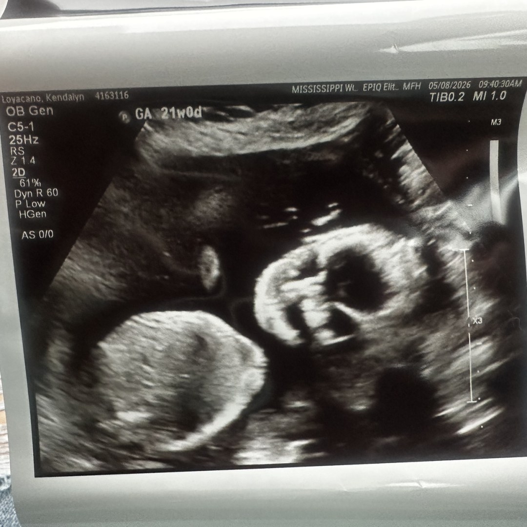 Photo shared by Kendal for their Babylist baby registry.