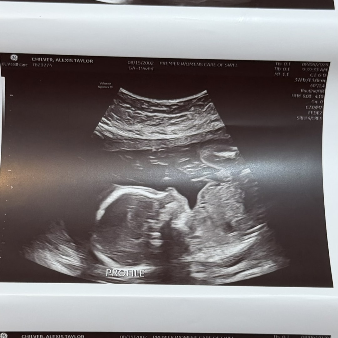 Photo shared by Alexis for their Babylist baby registry.