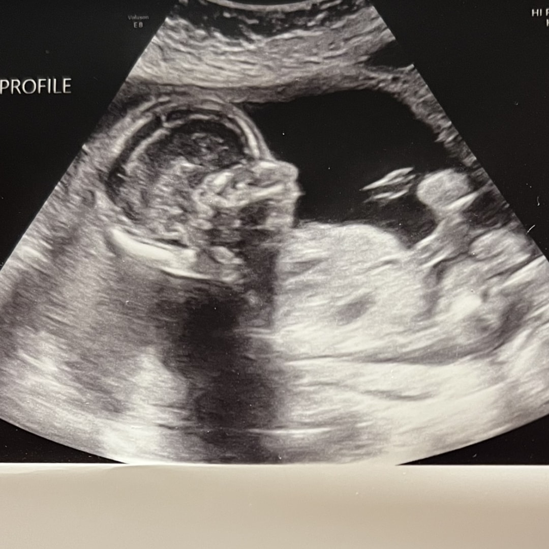 Photo shared by Annaleigh for their Babylist baby registry.