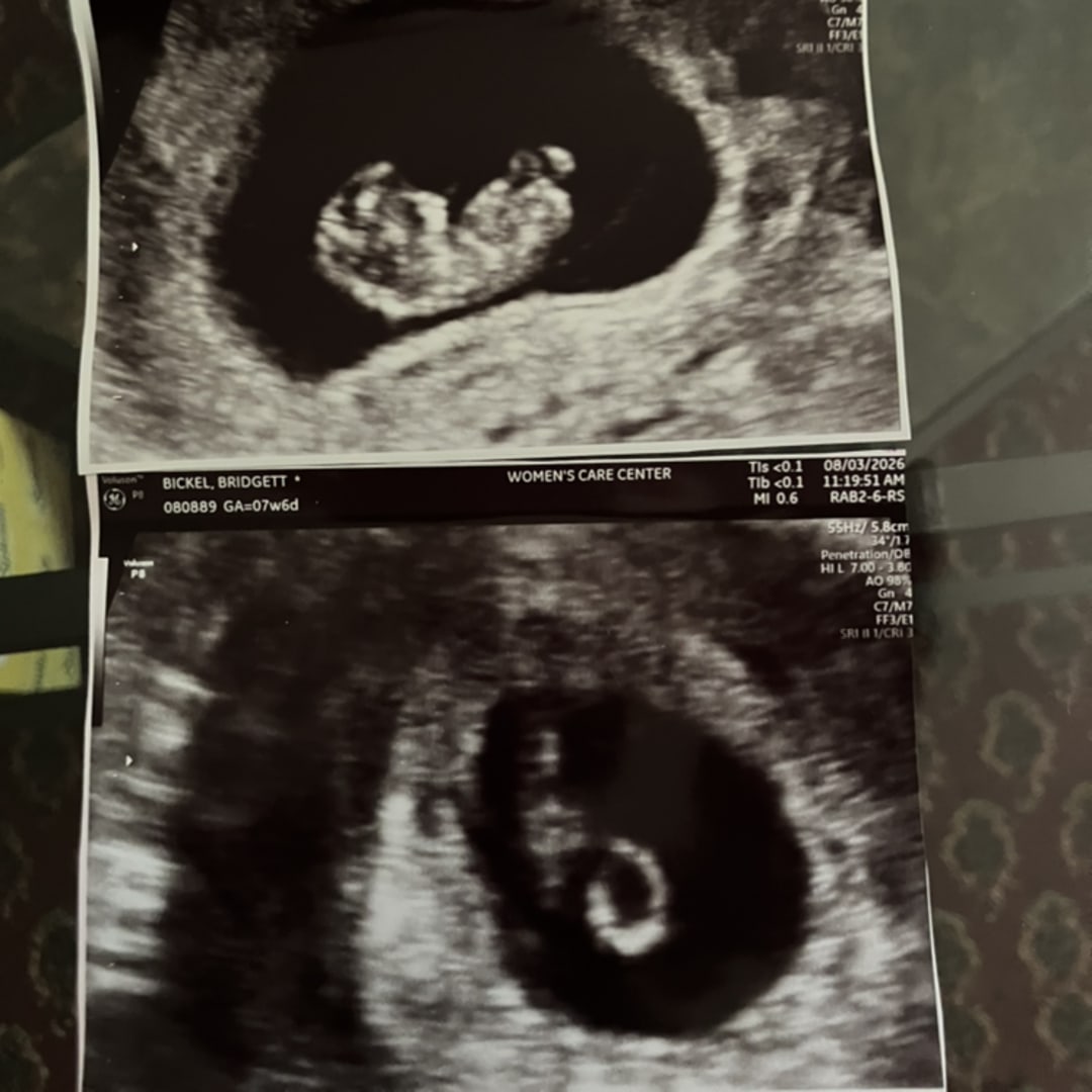 Photo shared by Bridgett for their Babylist baby registry.
