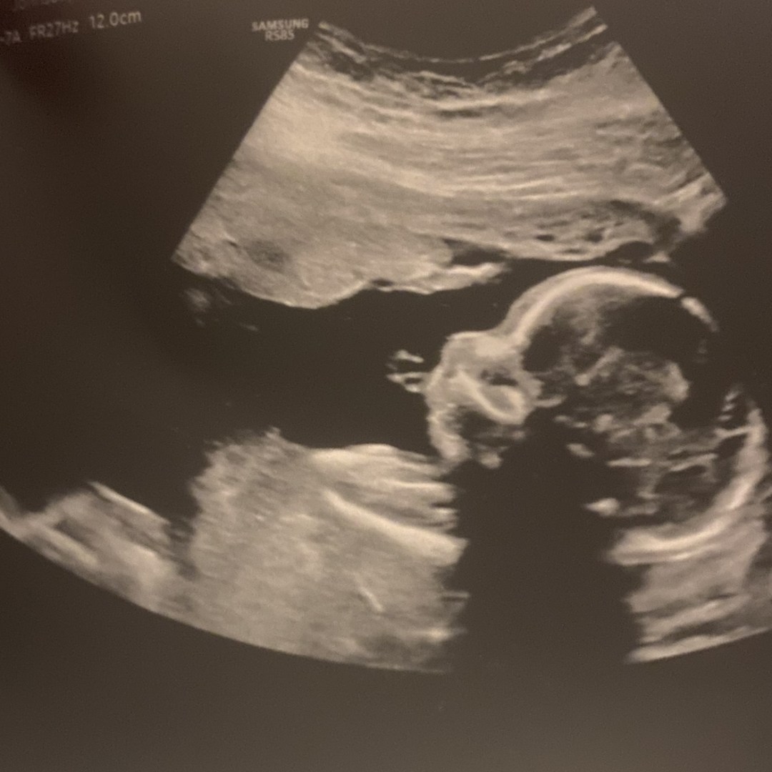 Photo shared by La Wanda for their Babylist baby registry.