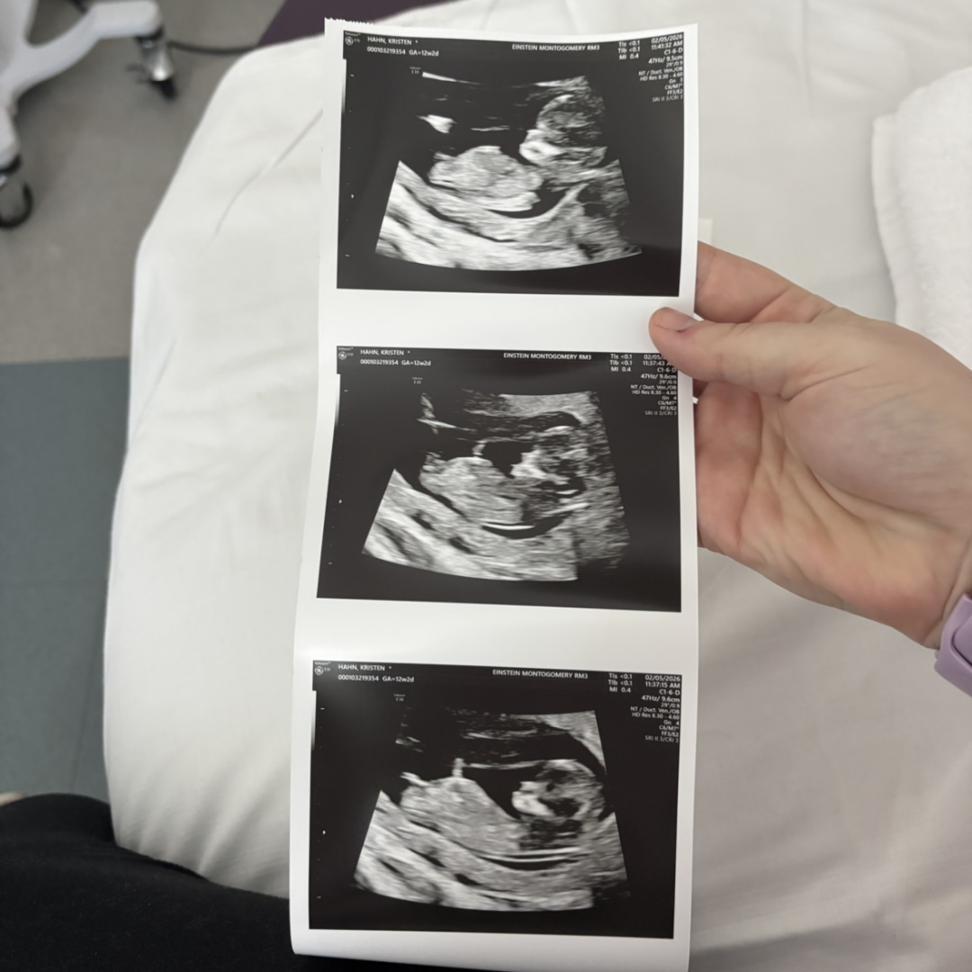 Photo shared by Kristin for their Babylist baby registry.