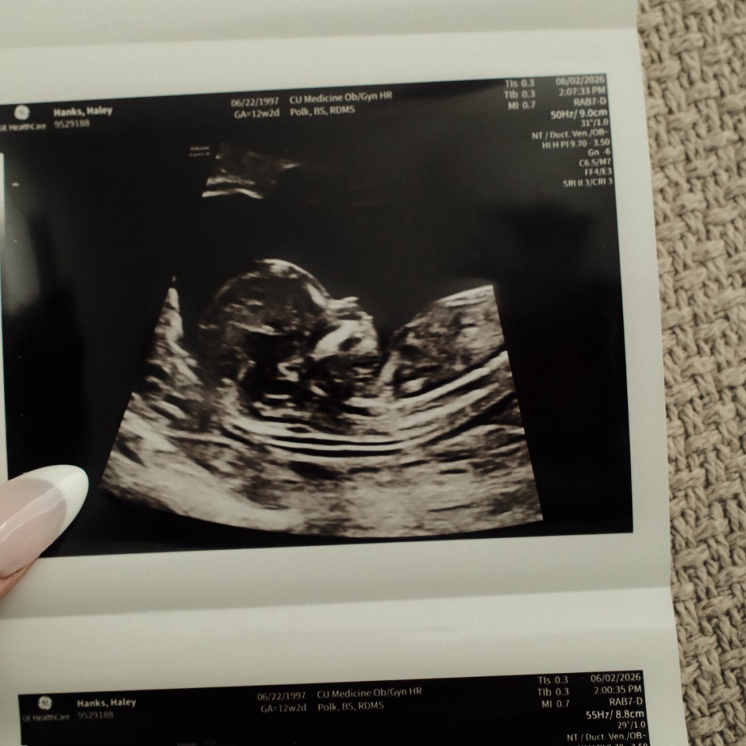 Photo shared by Haley for their Babylist baby registry.
