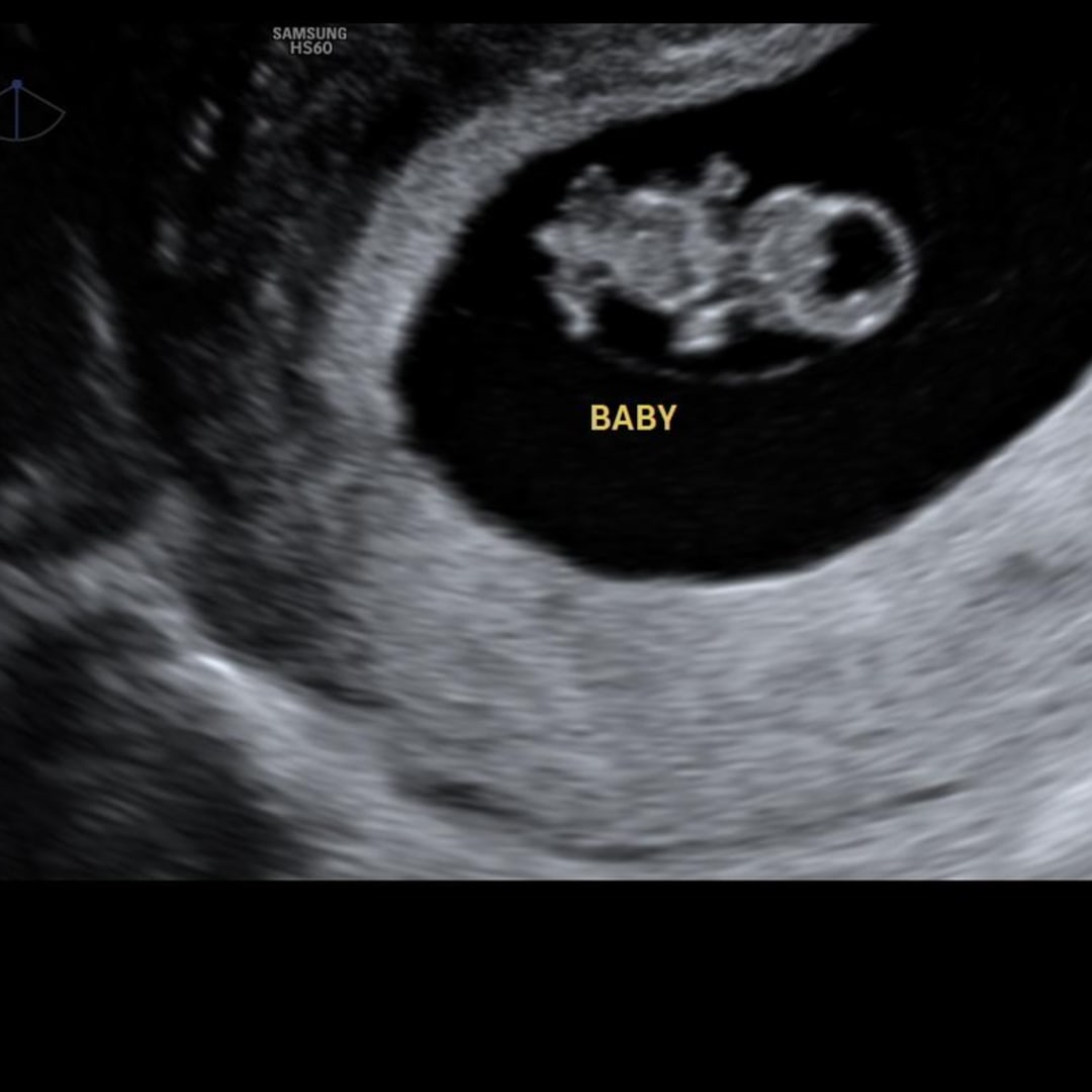 Photo shared by Alexandra for their Babylist baby registry.
