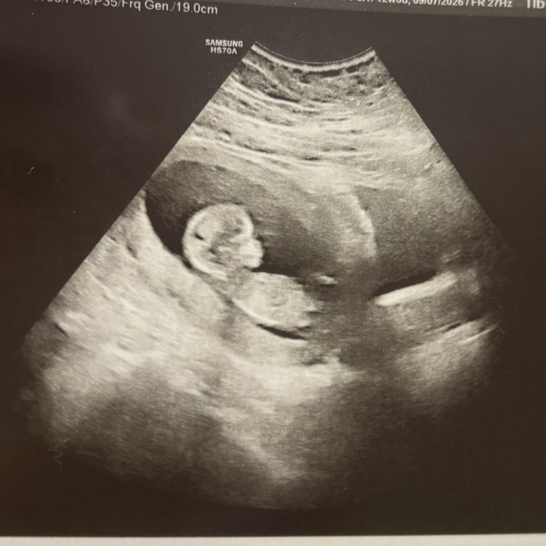 Photo shared by Kayla for their Babylist baby registry.