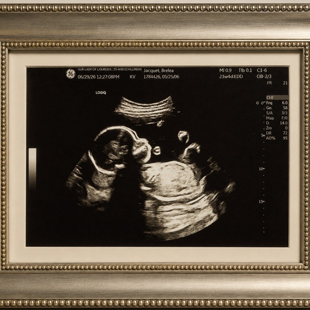Photo shared by Bee for their Babylist baby registry.