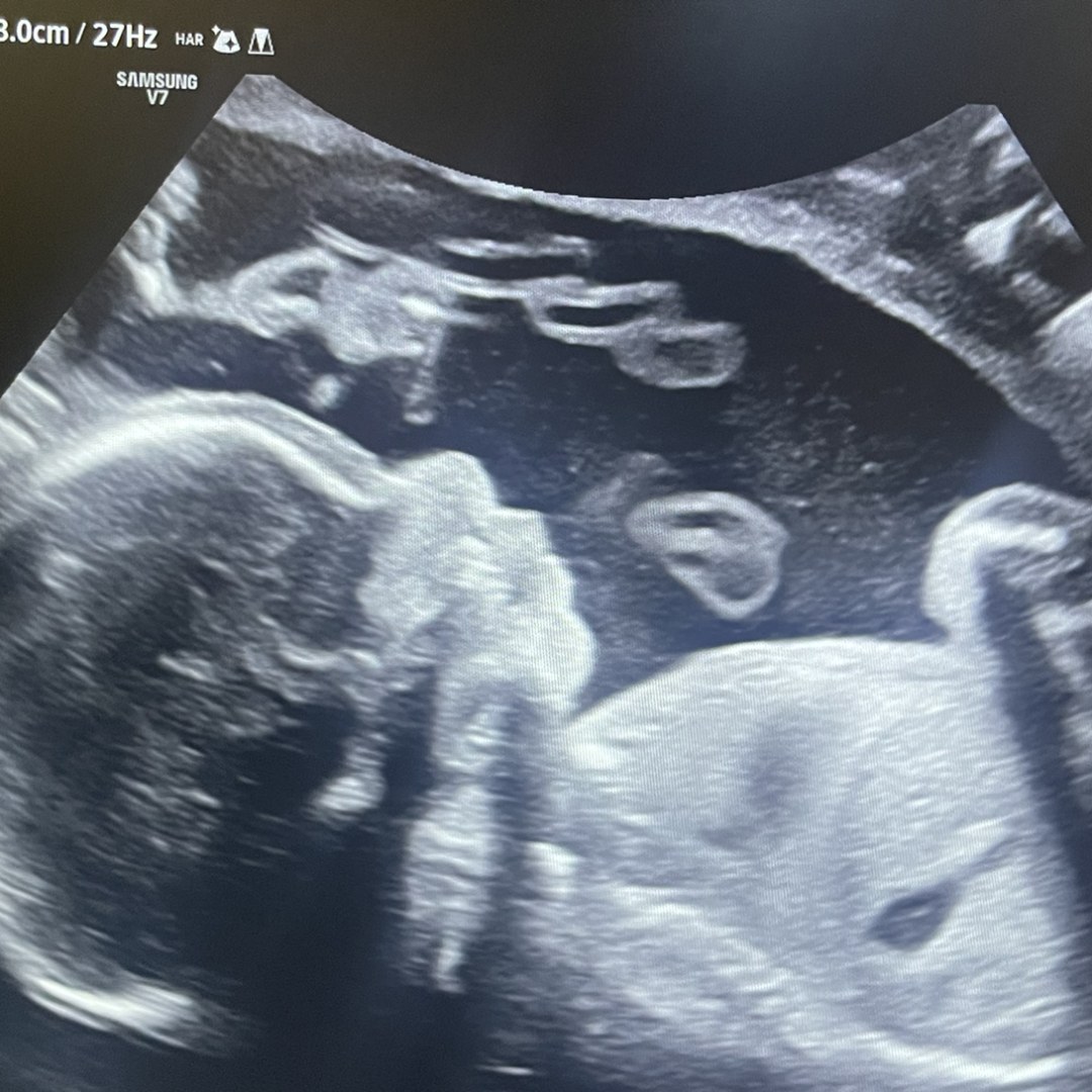 Photo shared by Brianne for their Babylist baby registry.