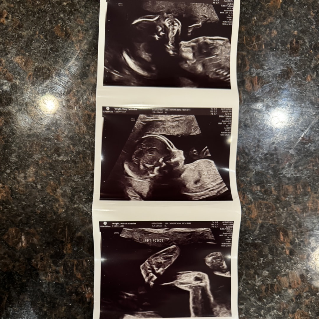Photo shared by MaryCatherine for their Babylist baby registry.