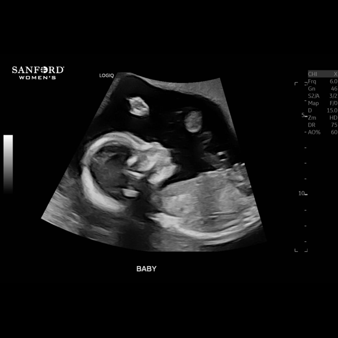 Photo shared by Lacey for their Babylist baby registry.