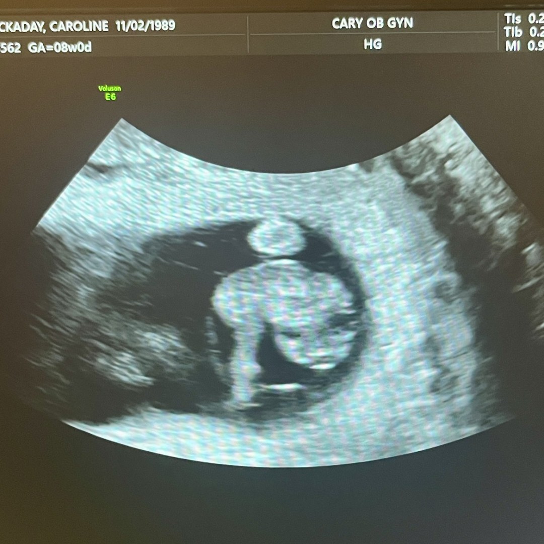 Photo shared by Caroline for their Babylist baby registry.