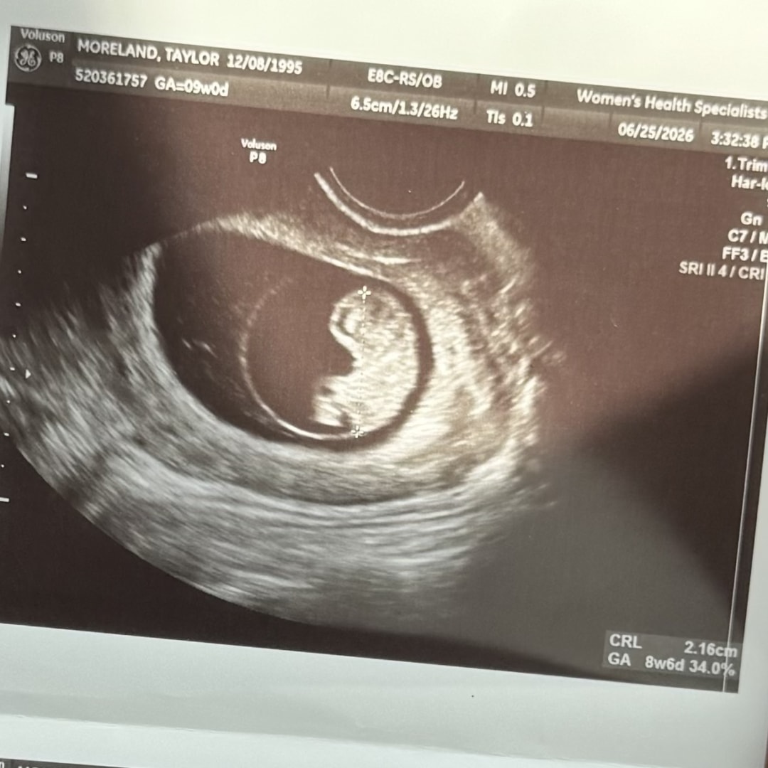 Photo shared by Taylor for their Babylist baby registry.